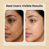 Glow Face Pack for Tan Removal & Brightening | Clay Face Mask to Clean Pores, Remove Blackheads & Dark Spots