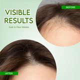 Rosemary Water Hair Growth Spray for Hair Fall